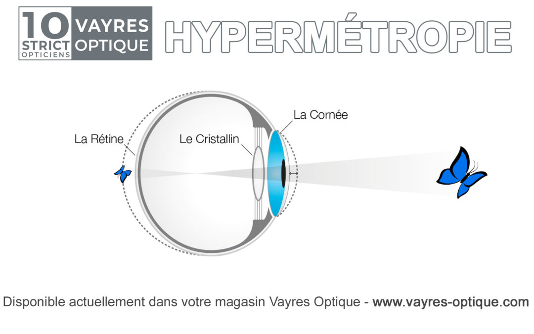 Information sur l’Hypermétropie