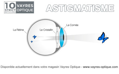 Information sur l’Astigmatisme